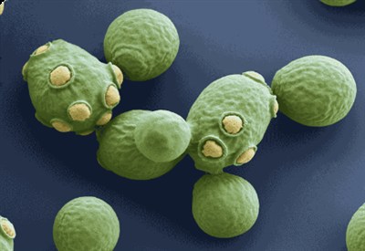 Saccharomyces cerevisiae