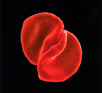 Copertina Scratch My Back